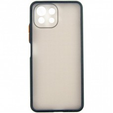 Чохол до моб. телефона Dengos Matte Xiaomi Mi 11 Lite (black) (DG-TPU-MATT-75) Чохол до моб. телефона Dengos Matte Xiaomi Mi 11 Lite (black) (DG-TPU-MATT-75)