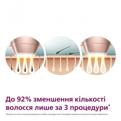 Фотоепілятор Philips Lumea IPL 9900 Series, акумуляторний , кіл-ть спалах.-450000, 2- 4 см2, насадок-4, футляр, рожевий Фотоепілятор Philips Lumea IPL 9900 Series, акумуляторний , кіл-ть спалах.-450000, 2- 4 см2, насадок-4, футляр, рожевий